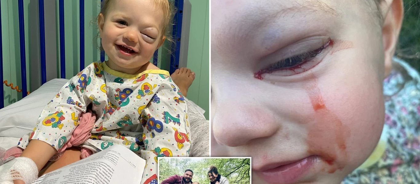 Αγγλία: Μπέμπα κλαίει δάκρυα από αίμα - Γεννήθηκε με όγκο στο μάτι (φωτό)